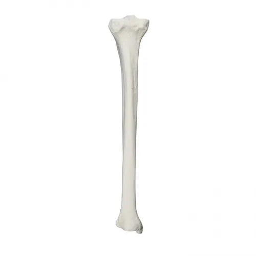 Left Tibia With Cancellous Material And Medullary Canal