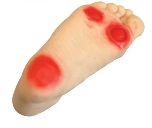 Advanced Diabetic Foot Care Model