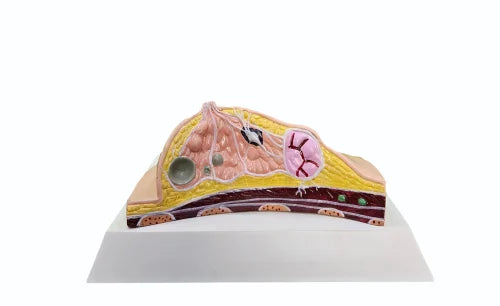 Breast Pathological Model