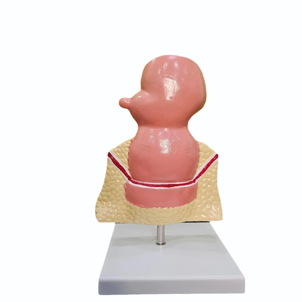 KKI-D015C Hemorrohids Model