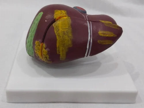 KKI-D035A Diseased Liver Model ( Small )
