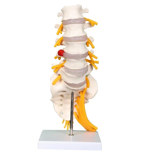 KKI-119 Lumbar Sacrum with Herniated Disc