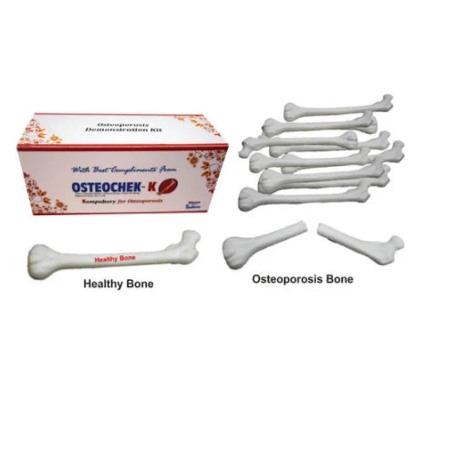 Osteoporosis Demonstration Model Kit