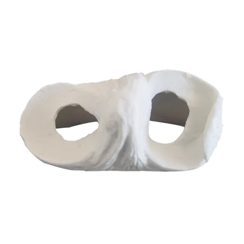 Meniscus Model (Round Cuts)