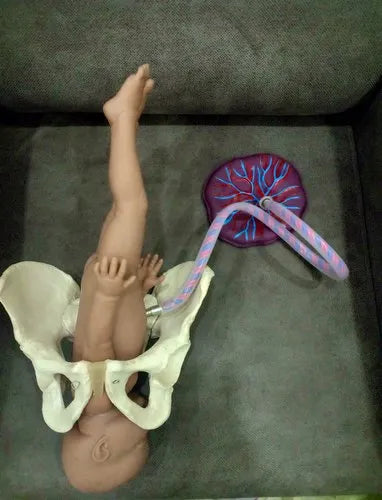 Female Pelvis With Umbilical Cord Model