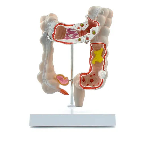 Colon Pathological Model – REVITI