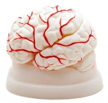 Plastic Brain Model