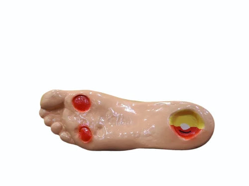 Diabetic Foot Model