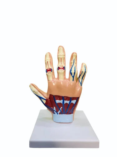 Hand Arthritis Model