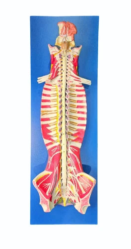 KKI-18102 Spinal Cord in Spinal Canal