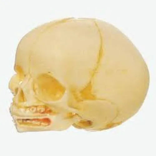 KKI-A11115 Infant Skull