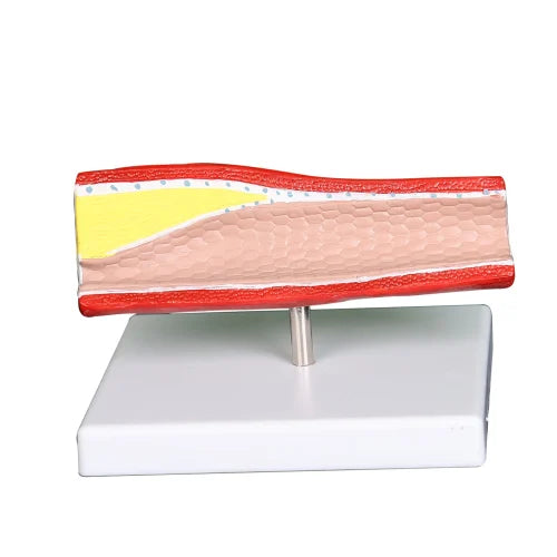 KKI-C017A Artery Model With Cross Section