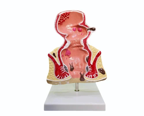 KKI-D015C Hemorrohids Model