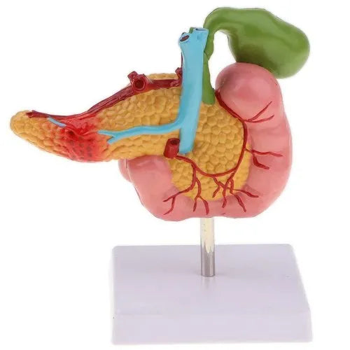 KKI D034A Diseased Pancreas, Spleen and Gall Bladder