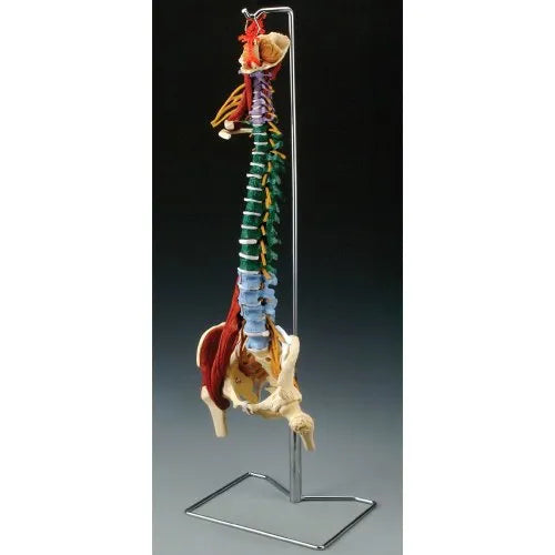 KKI-Life Size Spine With Muscles and Disorders