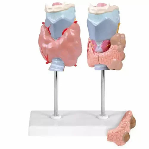 KKI-R034A Thyroid Disease Model
