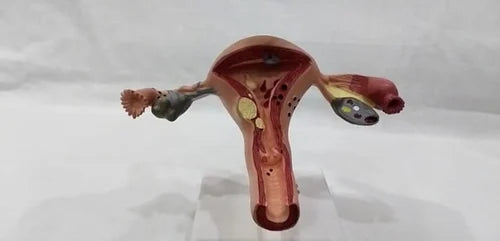 KKI-U043B Diseased Uterus Model