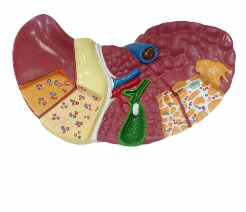 Liver Pathology Model