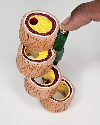 Progressive Artery Disease Model