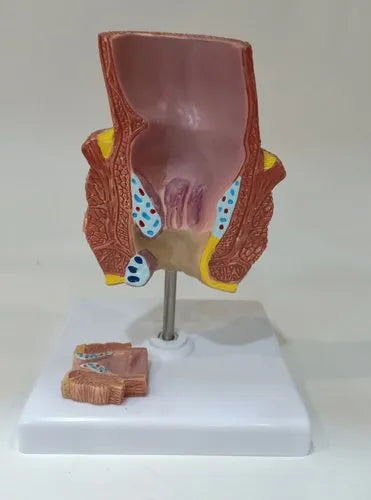 Rectum Disease Model