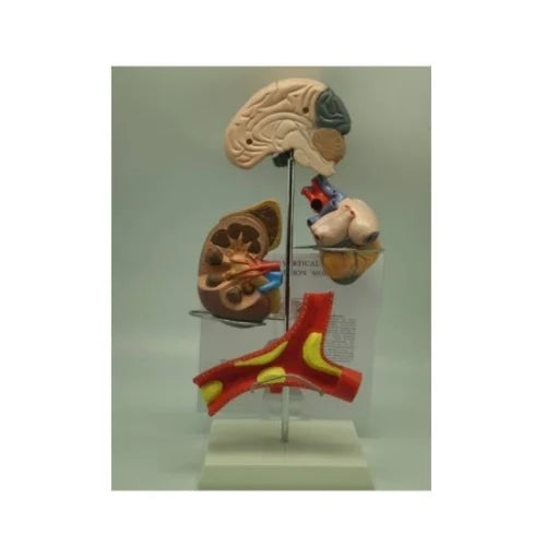 PVC Vertical Hypertension Model